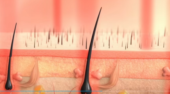 科学家发现刺激头发生长分子,头发稀疏怎么恢复