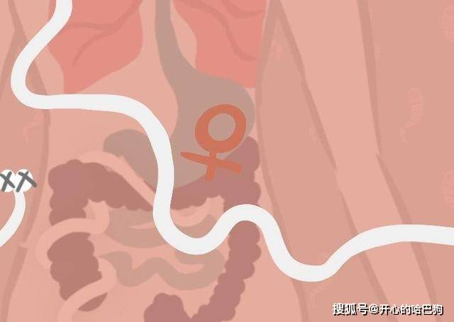 麦地那龙线虫病,雌虫会移行至皮肤?(有视频)